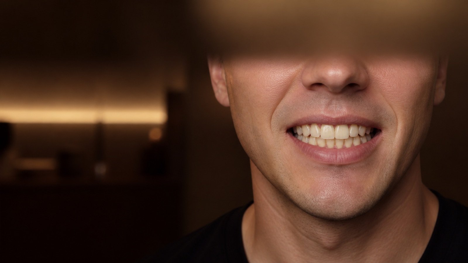 Asymetria zgryzu i uśmiechu — konsultacja i diagnostyka ortodontyczna